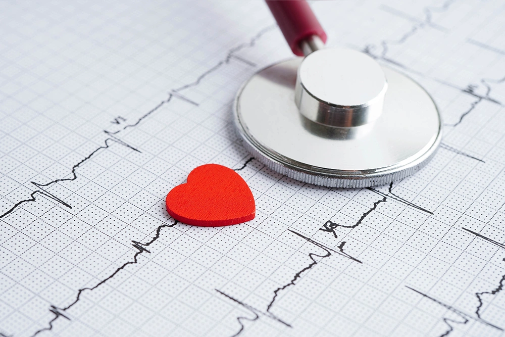 Managing Other Cardiac Causes of Chest Pain